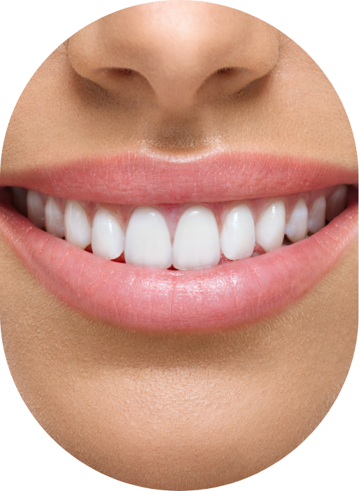 Les caractéristiques de la nouvelle méthode de restauration des dents postérieures