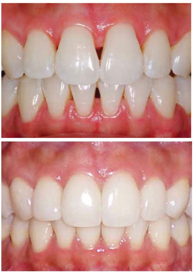 Dentiste_Centre-ville_Bioclear Bioclear